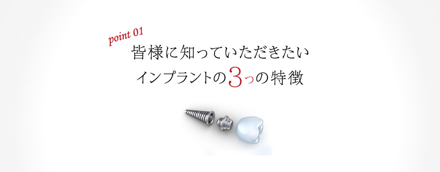 皆様に知っていただきたいインプラントの3つの特徴